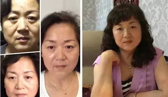 揪痧療法，傳統(tǒng)與現(xiàn)代結(jié)合的新探索
